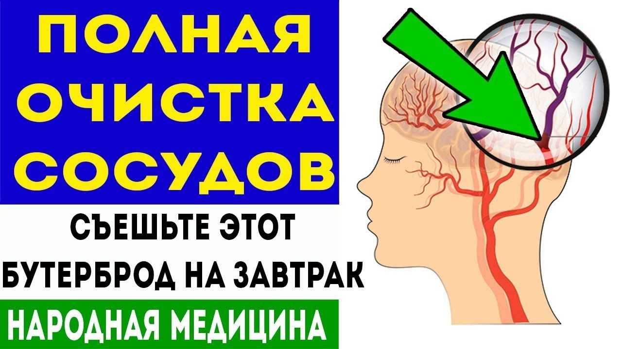 Как и чем быстро снизить высокое давление без таблеток - причины, диагностика и лечение